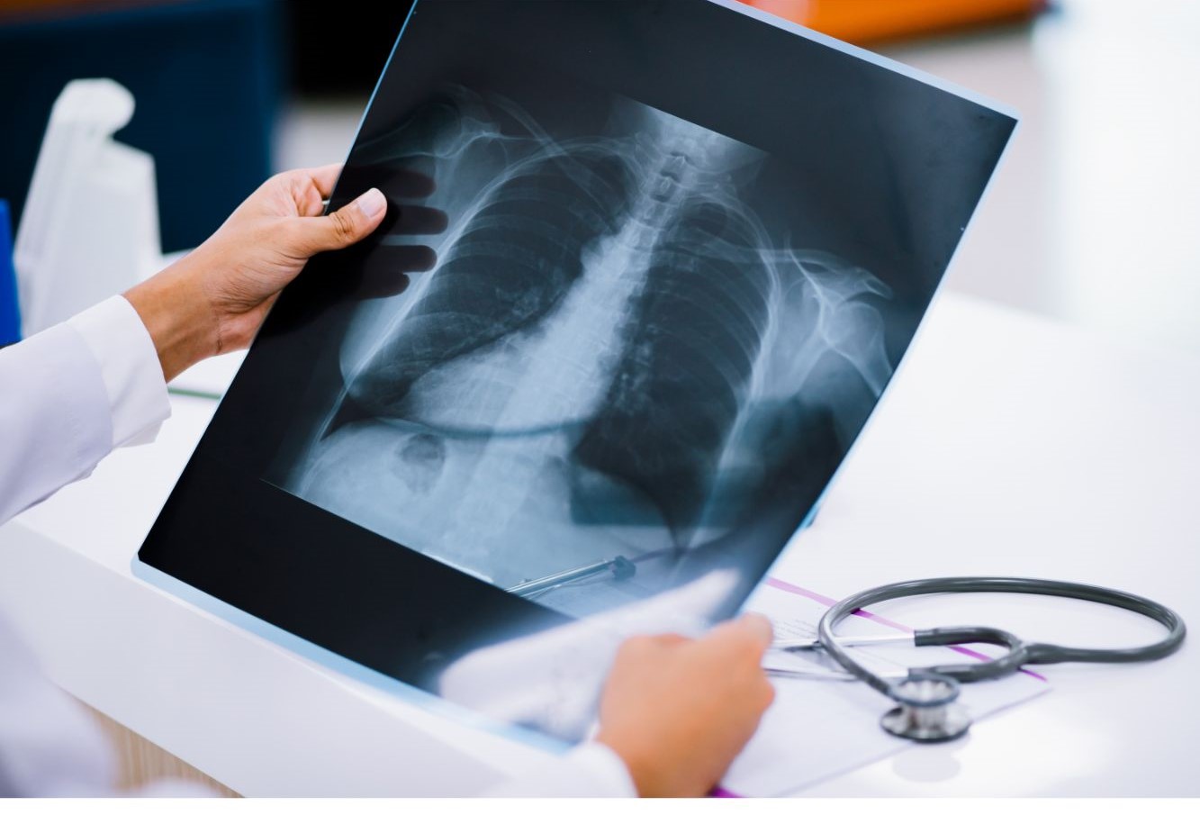 Chest Medicine Hospital In Pimpri-Chinchwad