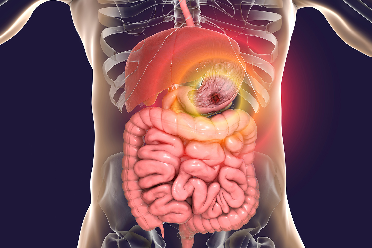 Gastroenterology Hospital In Pimpri-Chinchwad