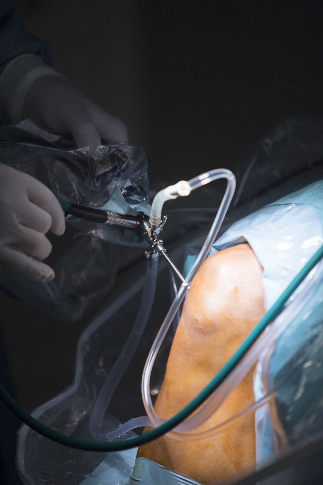 Orthoscopy Hospital In Pimpri-Chinchwad