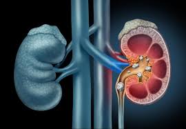 Urology hospital in Pimpri-Chinchwad